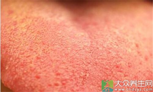 身上黄是哪里问题 f44d305ea09b1917609f29.jpg