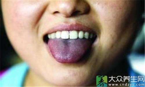 舌头少了一块舌苔图